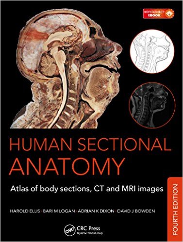 Human Sectional Anatomy: Atlas of Body Sections, CT and MRI Images, Fourth Edition – Original PDF
