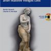 Encyclopedia of Body Sculpting After Massive Weight Loss – Original PDF + Videos