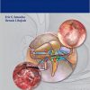 Cholesteatoma – Original PDF + Videos