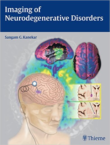 Imaging of Neurodegenerative Disorders – Original PDF