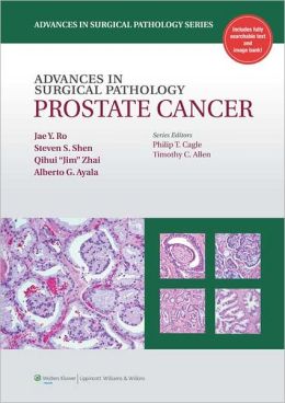 Advances in Surgical Pathology: Prostate Cancer – ORIGINAL PDF