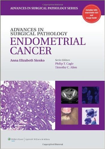 Advances in Surgical Pathology: Endometrial Carcinoma – ORIGINAL PDF