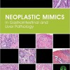 Neoplastic Mimics in Gastrointestinal and Liver Pathology (Pathology of Neoplastic Mimics) – Original PDF