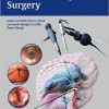 Neuroendoscopic Surgery – High Quality PDF