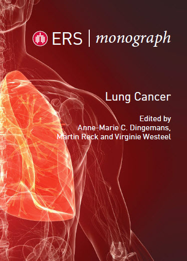 ERS Monograph : Lung Cancer