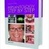 Implantology Step by Step – EPUB + Converted PDF
