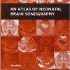 An Atlas of Neonatal Brain Sonography-Original PDF