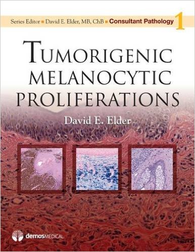 Consultant Pathology: Tumorigenic Melanocytic Proliferations – Original PDF