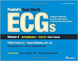 Podrid’s Real-World ECGs: A Master’s Approach to the Art and Practice of Clinical ECG Interpretation. Volume 4A, Arrhythmias: Core Cases-Original PDF