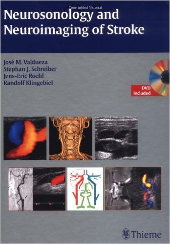 Neurosonology and Neuroimaging of Stroke