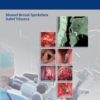 Transoral Laser Microsurgery of Benign and Malignant Lesions 1st Edition – Original PDF