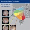 Sinonasal Complications of Dental Disease and Treatment: Prevention – Diagnosis – Management – Original PDF