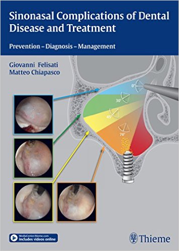 Sinonasal Complications of Dental Disease and Treatment: Prevention – Diagnosis – Management – PDF