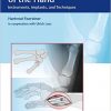 Osteosynthesis of the Hand: Instruments, Implants, and Techniques-Original PDF