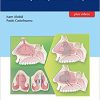 Nasoseptal Perforations: Endoscopic Repair Techniques – Original PDF+Videos+EPUB
