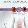Esofagitis eosinofílica clínicas iberoamericanas de gastroenterología y hepatología – Original PDF