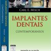 Implantes Dentais Contemporâneos (Em Portuguese do Brasil) – Original PDF
