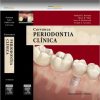 Carranza Periodontia Clinica (Em Portuguese do Brasil) – (ePub para PDF)