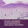 Recent Advances in Rhinosinusitis and Nasal Polyposis 1st Edition – Original PDF