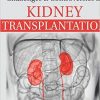 Challenges and Controversies in Kidney Transplantation-Original PDF