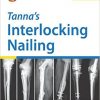 Tanna’s Interlocking Nailing 4th Edition – Original PDF