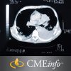 Lung Cancer Imaging 2016 – Videos + PDF